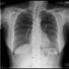 rx